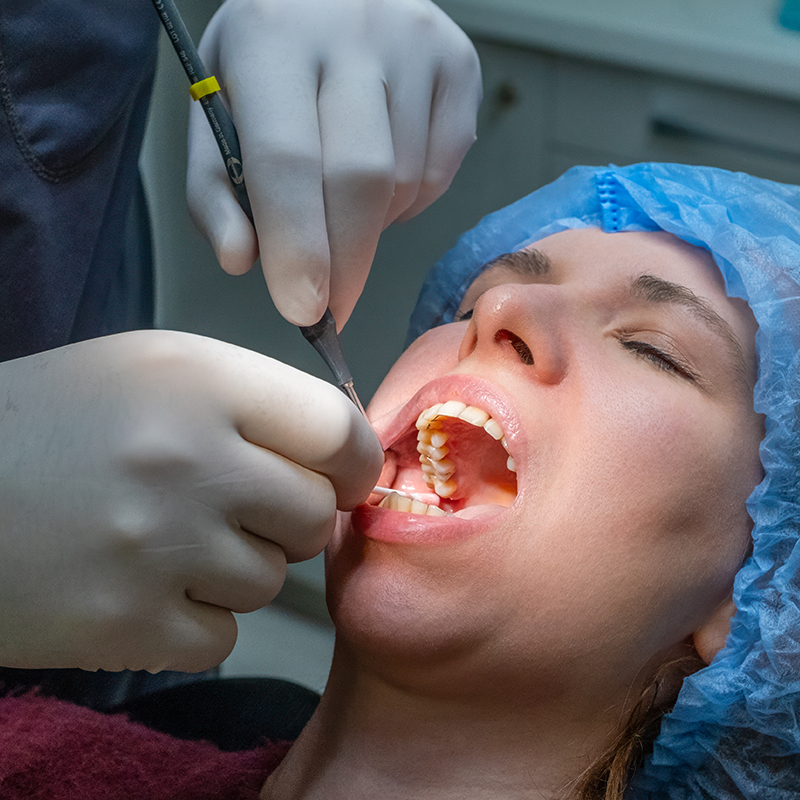 What to Expect During Your Surgical Wisdom Tooth Extraction