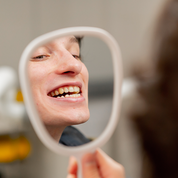 are dental veneer