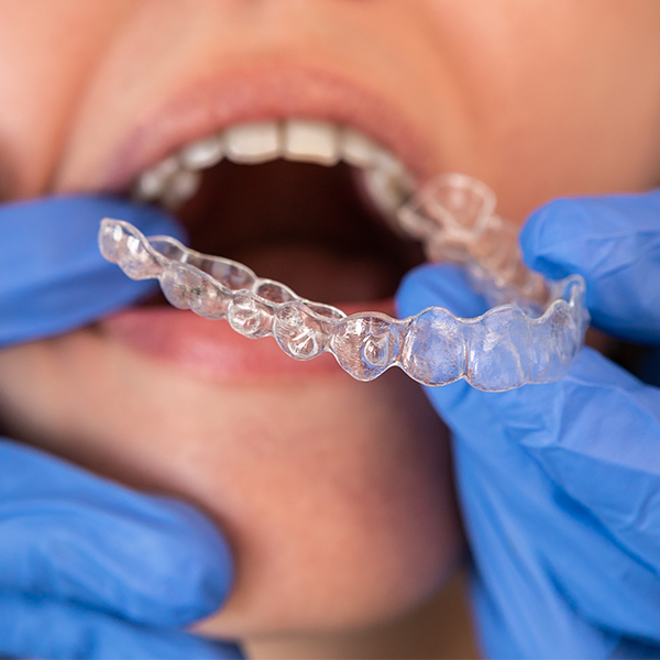 What Can Invisalign Treat