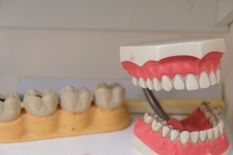 Upper and Lower Full Dentures Cost in Burlington